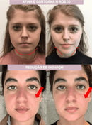 Modelador de Rosto - ProFace