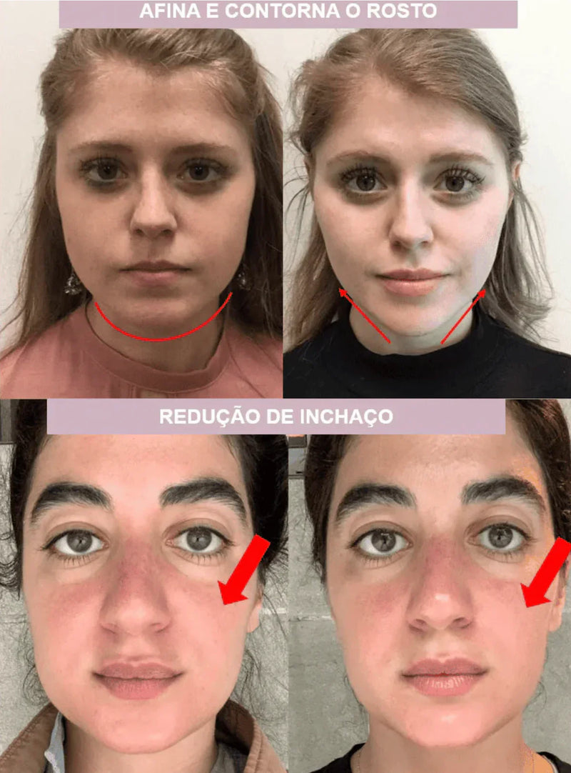 Modelador de Rosto - ProFace