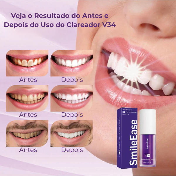 Clareador Dental Smile V34